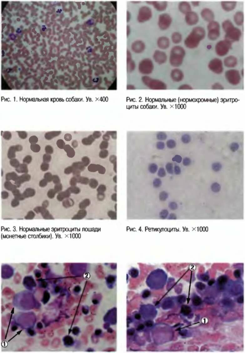 Анемии. Патогенетическая классификация